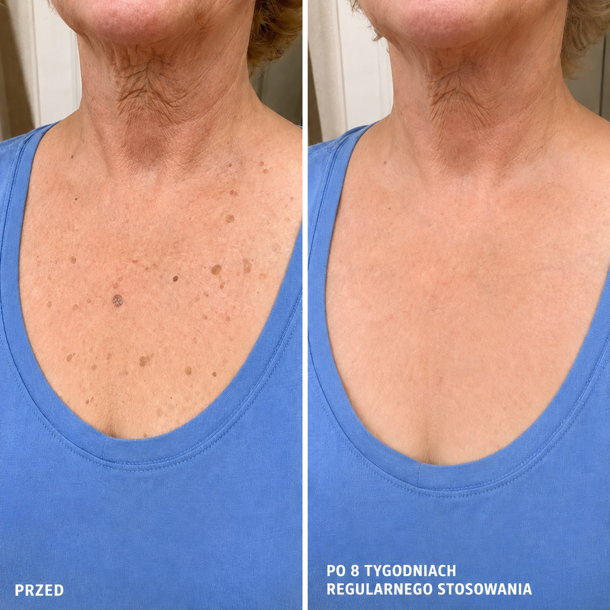 DermaSmooth 40 — Krem keratolityczny z mocznikiem 40% na zrogowacenia i zgrubienia